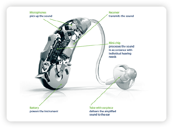 Anatomy of a hearing aid