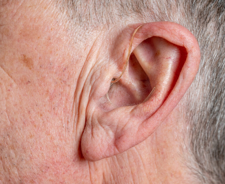 invisible hearing aid - close up of tiny modern hearing aid